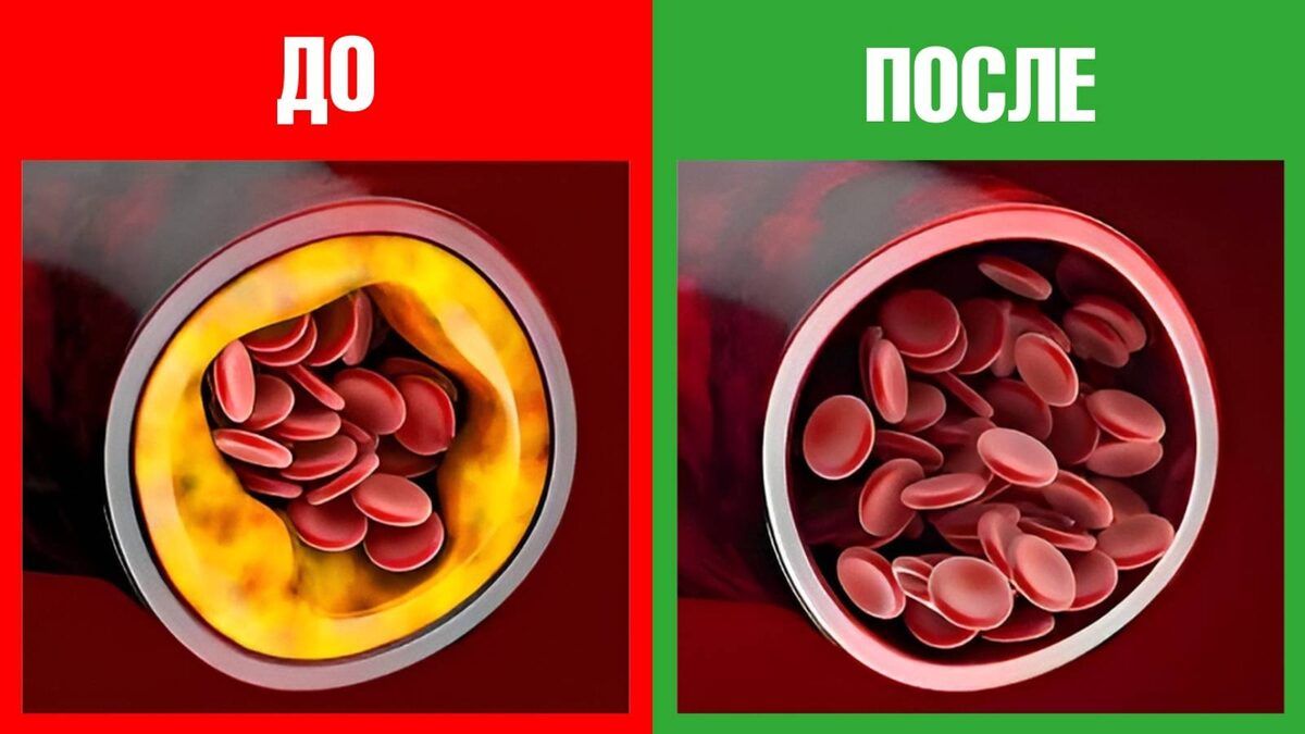 Как продукты повлияют на здоровье сердца в 2026 году